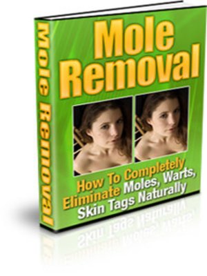 cover image of Mole Removal